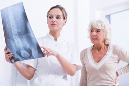 Der Arzt zeigt dem Patienten ein x-Strahlbild der Wirbelsäule