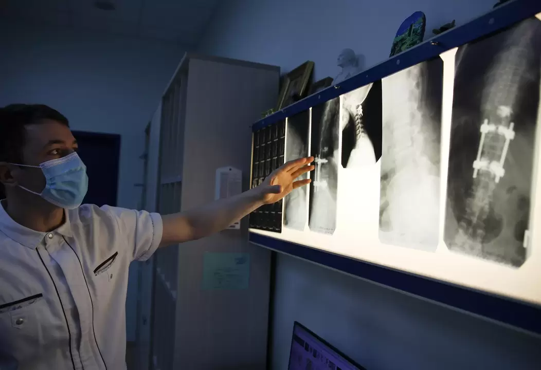 Ärzte diagnostizieren eine zervikale Osteochondrose mithilfe instrumenteller Methoden wie Röntgen. 